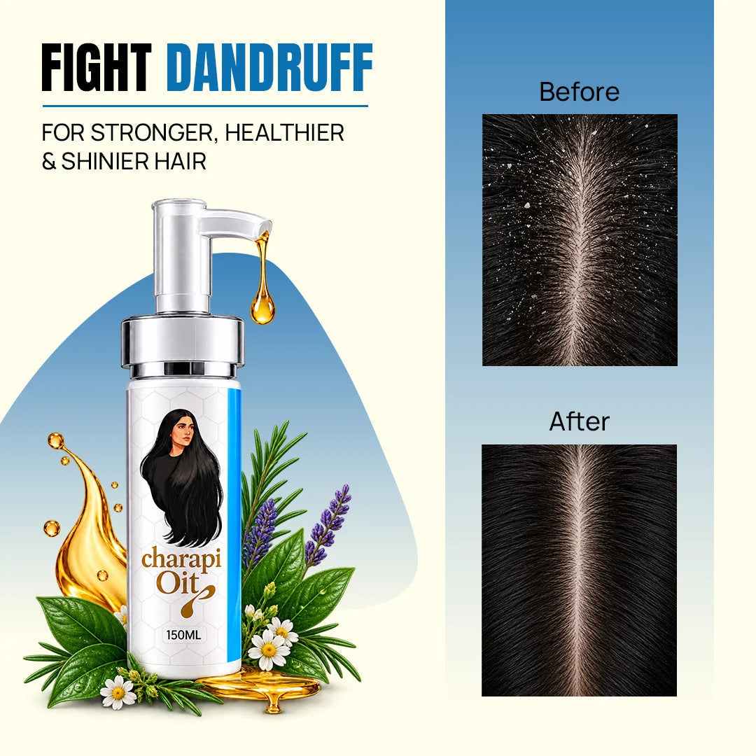 EXO - Dandruff Treatment Oil